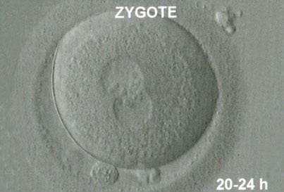 Komórka jajowa w stadium 2PN (dwa przedjądrza)