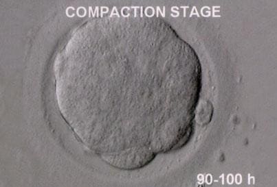 Prawidłowy zarodek w stadium kompaktacji