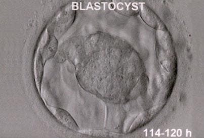 Zarodek w stadium blastocysty